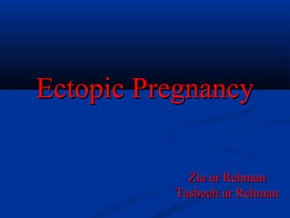 Ectopic PregnancyEctopic Pregnancy
Zia ur RehmanZia ur Rehman
Tasbeeh ur RehmanTasbeeh ur Rehman
 