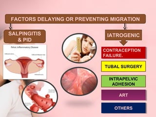 FACTORS DELAYING OR PREVENTING MIGRATION 
SALPINGITIS IATROGENIC 
& PID 
CONTRACEPTION 
FAILURE. 
CONTRACEPTION 
FAILURE. 
TUBAL SURGERY 
INTRAPELVIC 
ADHESION 
AARRTT 
OOTTHHEERRSS 
 