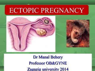 ECTOPIC PREGNANCY

Dr Manal Behery
Professor OB&GYNE
Zagazig university 2014

 