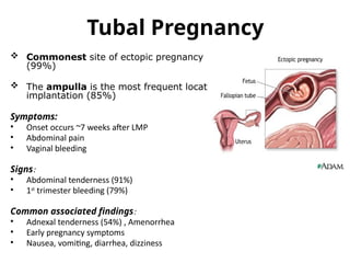Comprehensive Overview of Ectopic Pregnancy: Diagnosis, Risk Factors ...