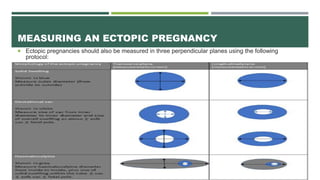 Eshre Rif Table Ectopic Pregnancy: New ESHRE terminology | PPTX