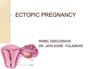 ECTOPIC PREGNANCY
PANEL DISCUSSION
DR JAYA KORE -TULASKAR
 