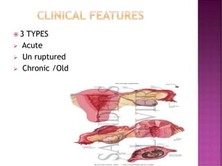  3 TYPES
 Acute
 Un ruptured
 Chronic /Old
 