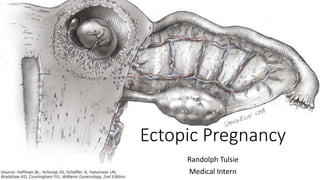 Ectopic Pregnancy
Randolph Tulsie
Medical Intern
 