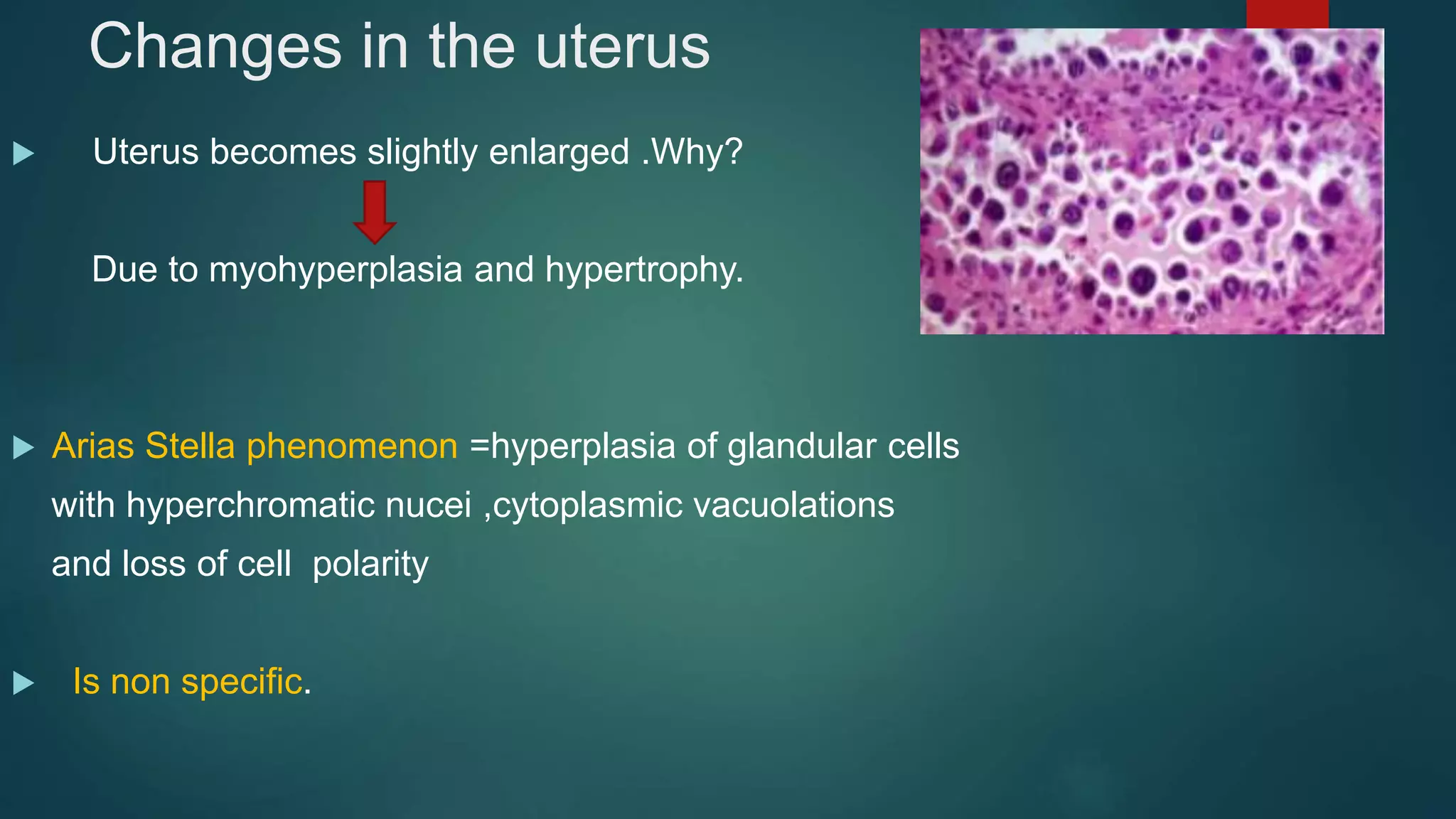 Changes in the uterus
 Uterus becomes slightly enlarged .Why?
Due to myohyperplasia and hypertrophy.
 Arias Stella phenomenon =hyperplasia of glandular cells
with hyperchromatic nucei ,cytoplasmic vacuolations
and loss of cell polarity
 Is non specific.
 