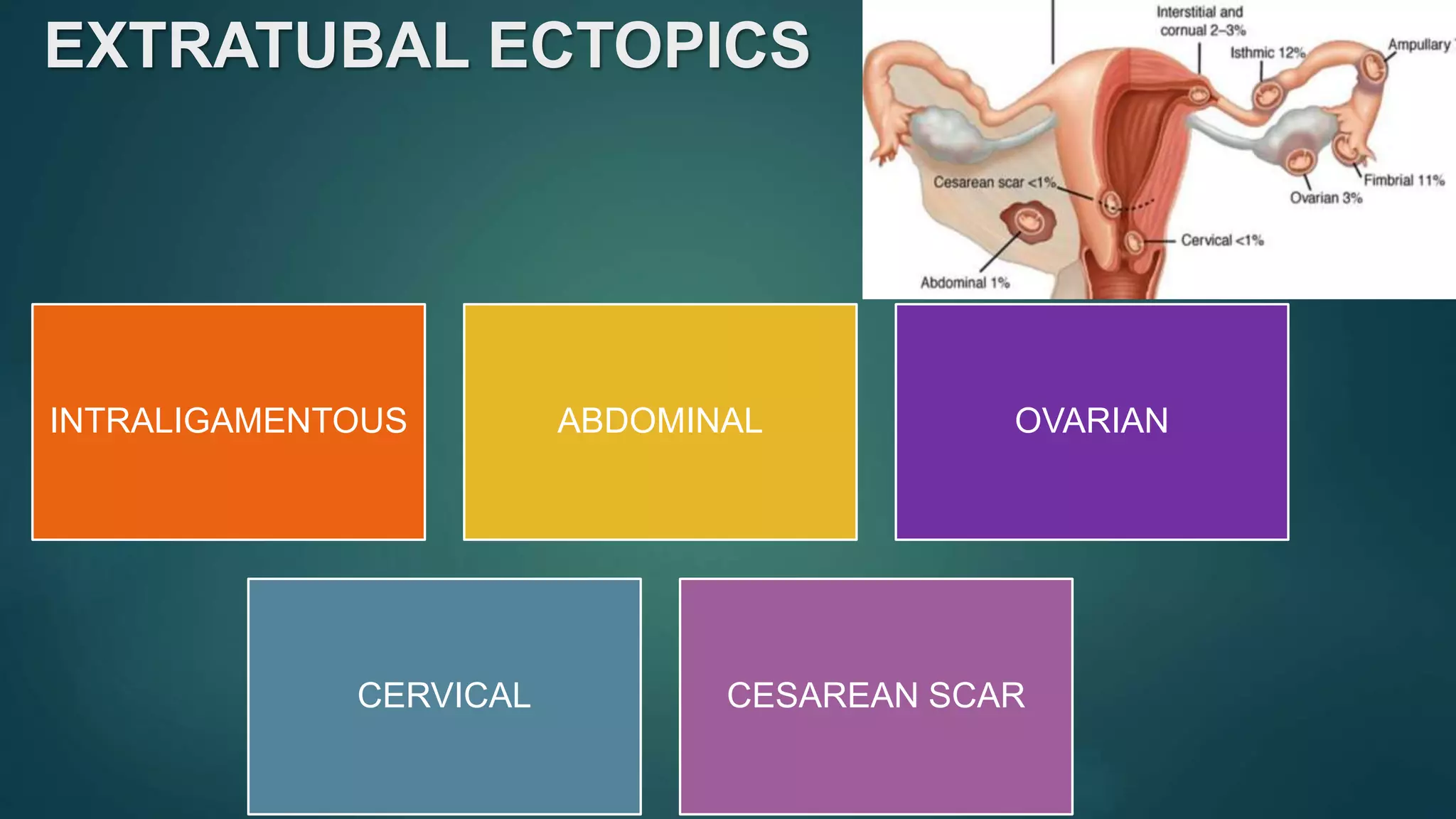 EXTRATUBAL ECTOPICS
INTRALIGAMENTOUS ABDOMINAL OVARIAN
CERVICAL CESAREAN SCAR
 