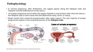 Pathophysiology
• In normal pregnancy, after fertilization, the zygote passes along the fallopian tube and
implants into the endometrium of the uterus
• An ectopic pregnancy occurs when the zygote implants in any location other than the uterus—
the fallopian tube or extra tubal sites (the abdominal cavity, cervix, or ovary)
• Death results from maternal exsanguination after tubal rupture. The vast majority of ectopic
pregnancies implant in the ampullary portion of the fallopian tube.
www.draliabadi.com/obstetrics/abnormal-pregnancy-conditions/ectopic-pregnancy
 