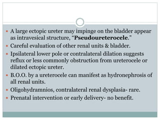  A large ectopic ureter may impinge on the bladder appear
as intravesical structure, “Pseudoureterocele.”
 Careful evaluation of other renal units & bladder.
 Ipsilateral lower pole or contralateral dilation suggests
reflux or less commonly obstruction from ureterocele or
dilated ectopic ureter.
 B.O.O. by a ureterocele can manifest as hydronephrosis of
all renal units.
 Oligohydramnios, contralateral renal dysplasia- rare.
 Prenatal intervention or early delivery- no benefit.
 