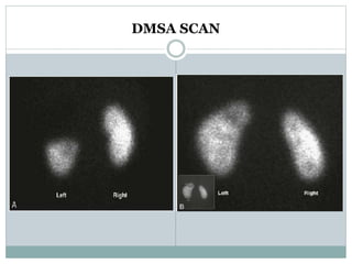 DMSA SCAN
 