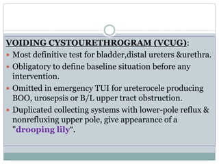 VCUG of duplex system ureterocele with reflux into
lower moiety
ureterocele
Reflux into lower moiety
Everting
ureterocele
 