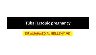 Tubal Ectopic pregnancy
DR MUAHMED AL BELLEHY MD
 