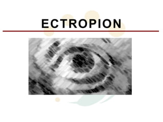 ECTROPION
 