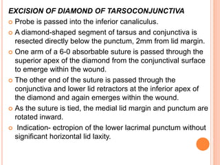 EXCISION OF DIAMOND OF TARSOCONJUNCTIVA
 Probe is passed into the inferior canaliculus.
 A diamond-shaped segment of tarsus and conjunctiva is
resected directly below the punctum, 2mm from lid margin.
 One arm of a 6-0 absorbable suture is passed through the
superior apex of the diamond from the conjunctival surface
to emerge within the wound.
 The other end of the suture is passed through the
conjunctiva and lower lid retractors at the inferior apex of
the diamond and again emerges within the wound.
 As the suture is tied, the medial lid margin and punctum are
rotated inward.
 Indication- ectropion of the lower lacrimal punctum without
significant horizontal lid laxity.
 