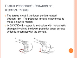 TRABUT PROCEDURE:-ROTATION OF
TERMINAL TARSUS
 The tarsus is cut & the lower portion rotated
through 180°. The posterior lamella is advanced to
make a new lid margin.
 INDICATIONS:- upper lid entropion with metaplastic
changes involving the lower posterior tarsal surface
which is in contact with the cornea.
 