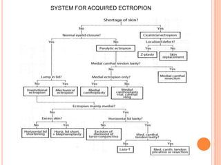 SYSTEM FOR ACQUIRED ECTROPION
 