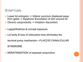 SYMPTOMS
 Lower lid ectropion -> Inferior punctum displaced away
from globe -> Epiphora/ Excoriation of skin around lid.
 Chronic conjunctivitis -> Irritation/ discomfort.
 Lagophthalmos & corneal exposure.
 Lid laxity & loss of orbicularis tone eliminates the
lacrimal pump mechanism—FLACCID CANALICULAR
SYNDROME.
 KERATINISATION of exposed conjunctiva
 