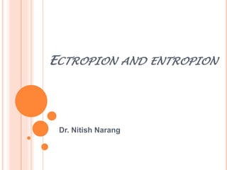 ECTROPION AND ENTROPION
Dr. Nitish Narang
 