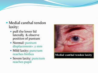  Medial canthal tendon
laxity:
 pull the lower lid
laterally & observe
position of puntum
 Normal: puntum
displacement< 2 mm
 Mild laxity: punctum
reaches limbus
 Severe laxity: punctum
reaches pupil
 