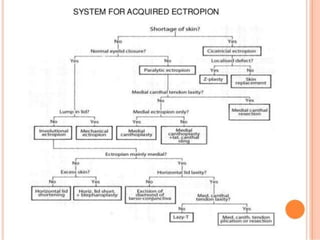 Ectropion and Entropion.pptx