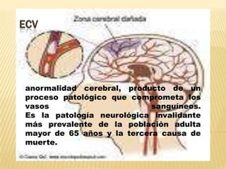 ECV anormalidad cerebral, producto de un proceso patológico que comprometa los vasos sanguíneos.Es la patología neurológica invalidante más prevalente de la población adulta mayor de 65 años y la tercera causa de muerte. 