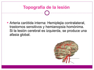 Topografía de la lesión  Arteria carótida interna: Hemiplejia contralateral, trastornos sensitivos y hemianopsia homónima. Si la lesión cerebral es izquierda, se produce una afasia global. 