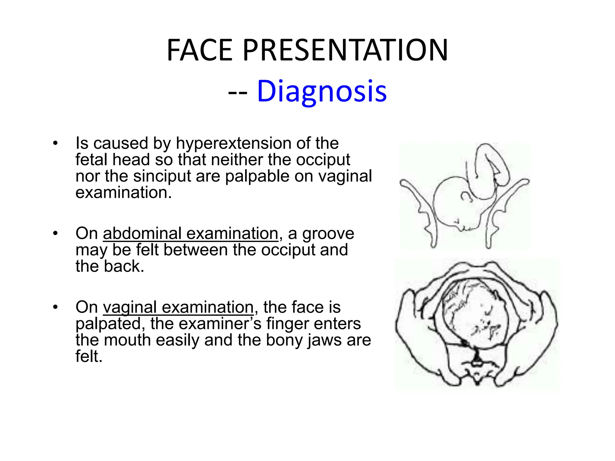 FACE PRESENTATION
-- Diagnosis
• Is caused by hyperextension of the
fetal head so that neither the occiput
nor the sinciput are palpable on vaginal
examination.
• On abdominal examination, a groove
may be felt between the occiput and
the back.
• On vaginal examination, the face is
palpated, the examiner’s finger enters
the mouth easily and the bony jaws are
felt.
 