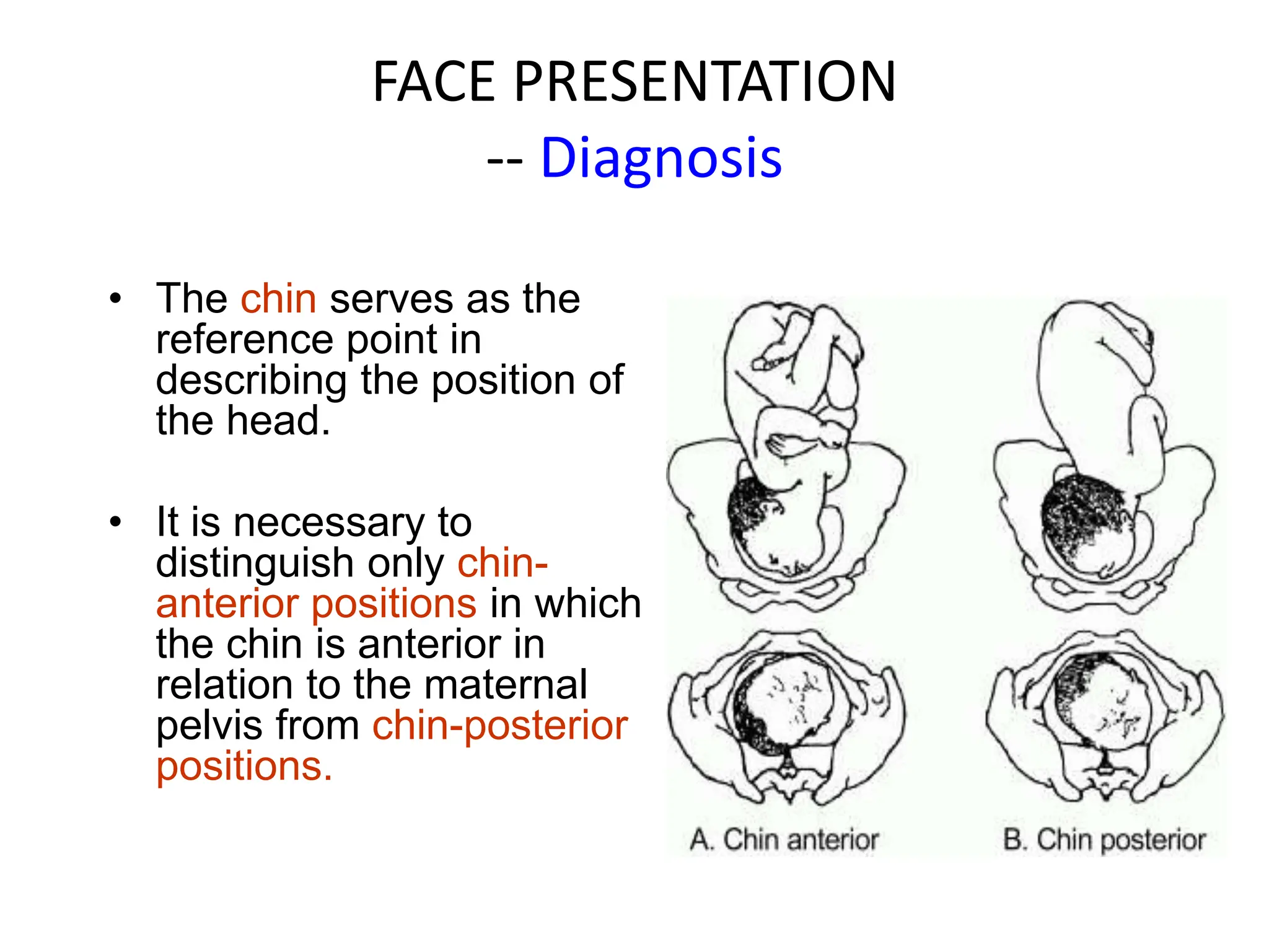 FACE PRESENTATION
-- Diagnosis
• The chin serves as the
reference point in
describing the position of
the head.
• It is necessary to
distinguish only chin-
anterior positions in which
the chin is anterior in
relation to the maternal
pelvis from chin-posterior
positions.
 
