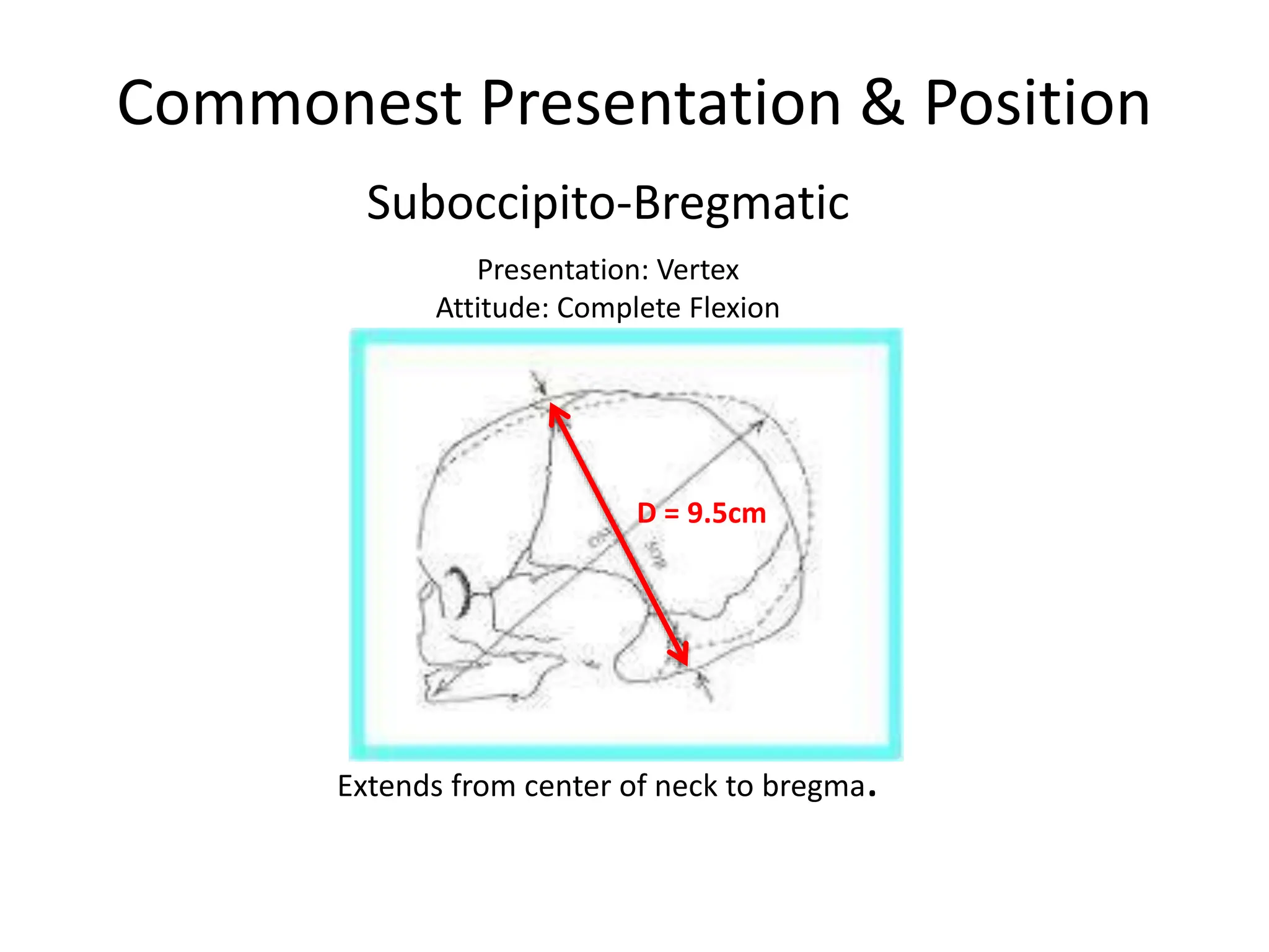 Commonest Presentation & Position
Suboccipito-Bregmatic
Extends from center of neck to bregma.
Presentation: Vertex
Attitude: Complete Flexion
D = 9.5cm
 