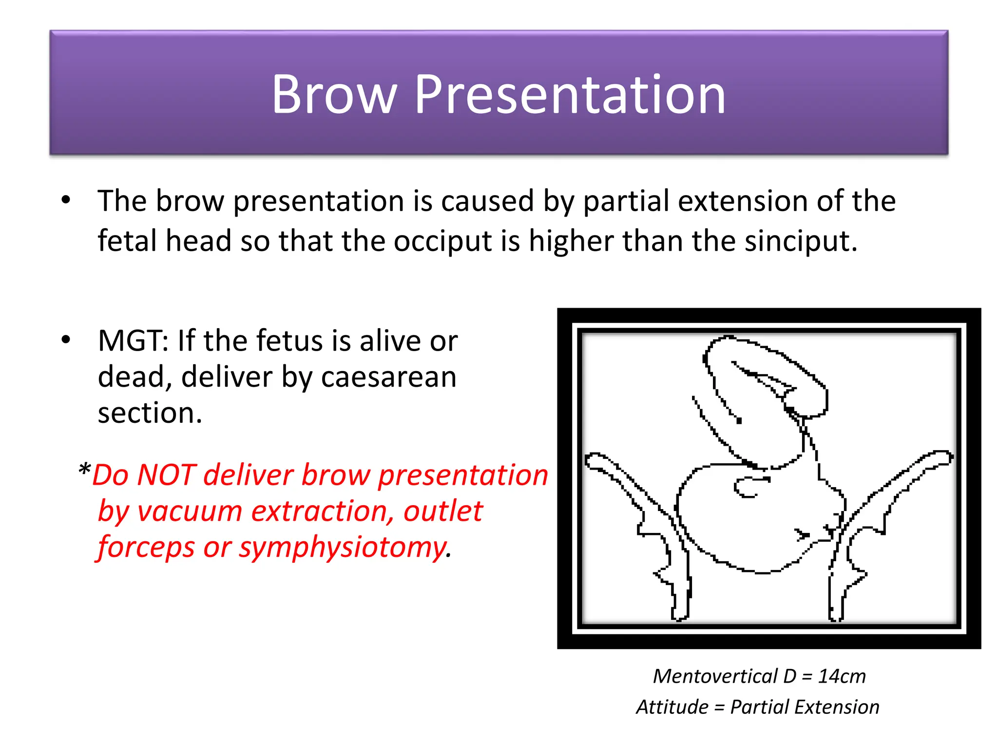 Brow Presentation
• The brow presentation is caused by partial extension of the
fetal head so that the occiput is higher than the sinciput.
• MGT: If the fetus is alive or
dead, deliver by caesarean
section.
*Do NOT deliver brow presentation
by vacuum extraction, outlet
forceps or symphysiotomy.
Mentovertical D = 14cm
Attitude = Partial Extension
 