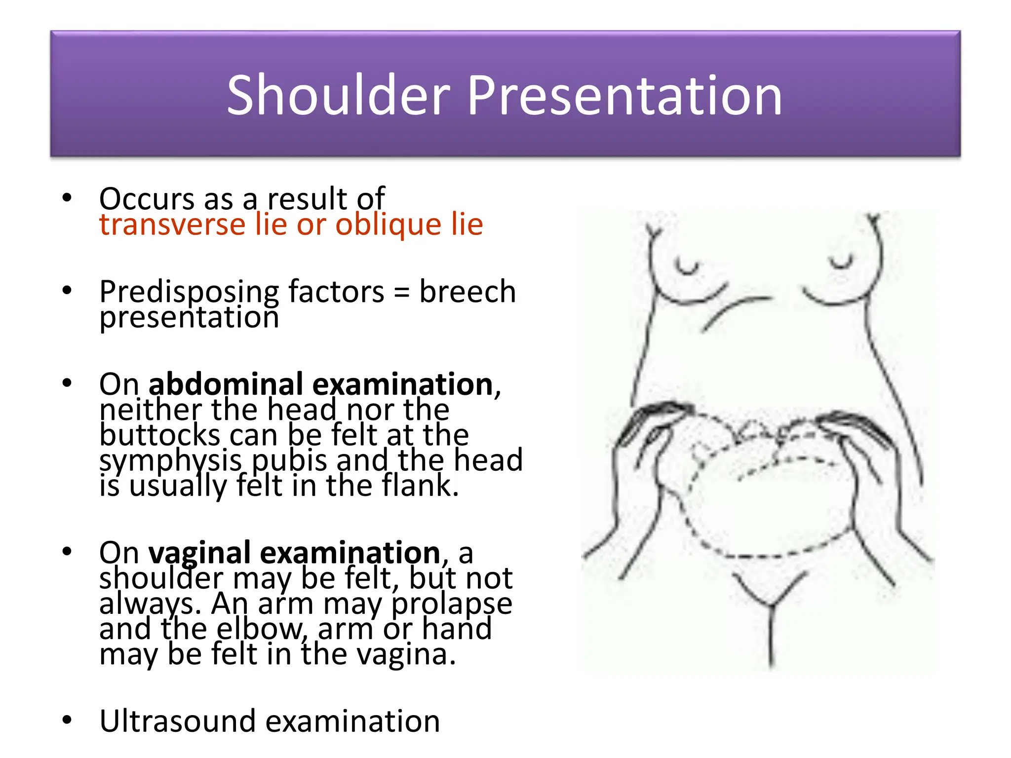 Shoulder Presentation
• Occurs as a result of
transverse lie or oblique lie
• Predisposing factors = breech
presentation
• On abdominal examination,
neither the head nor the
buttocks can be felt at the
symphysis pubis and the head
is usually felt in the flank.
• On vaginal examination, a
shoulder may be felt, but not
always. An arm may prolapse
and the elbow, arm or hand
may be felt in the vagina.
• Ultrasound examination
 
