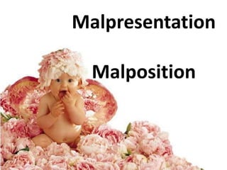 Malpresentation
Malposition
 