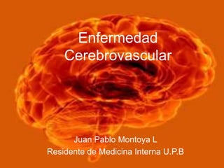 Enfermedad Cerebrovascular Juan Pablo Montoya L Residente de Medicina Interna U.P.B 