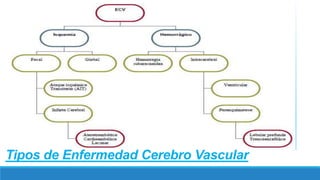 Tipos de Enfermedad Cerebro Vascular
 