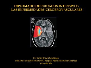 DIPLOMADO DE CUIDADOS INTENSIVOS
LAS ENFERMEDADES CEROBROVASCULARES
Dr. Carlos Brown Sotolongo
Unidad de Cuidados Intensivos. Hospital Abel Santamaría Cuadrado
Pinar del Río
 