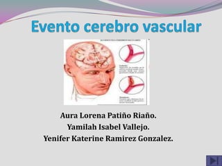 Evento cerebro vascular Aura Lorena Patiño Riaño. Yamilah Isabel Vallejo. Yenifer Katerine Ramirez Gonzalez. 