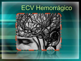 ECV Hemorrágico
 