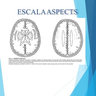 ESCALAASPECTS
 