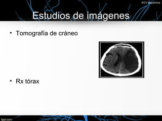 ECV Isquemica




       Estudios de imágenes
• Tomografía de cráneo




• Rx tórax
 
