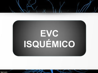 EVC
ISQUÉMICO
 