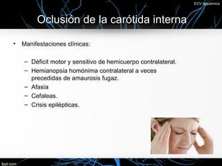 ECV Isquemica



         Oclusión de la carótida interna

•   Manifestaciones clínicas:

     – Déficit motor y sensitivo de hemicuerpo contralateral.
     – Hemianopsia homónima contralateral a veces
       precedidas de amaurosis fugaz.
     – Afasia
     – Cefaleas.
     – Crisis epilépticas.
 
