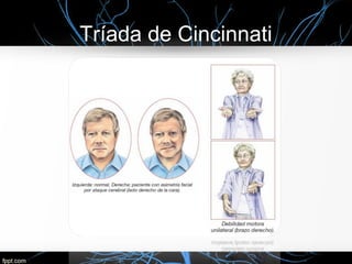 Tríada de Cincinnati
 