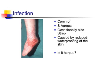 Infection Common S Aureus Occasionally also Strep Caused by reduced waterproofing of the skin Is it herpes?  