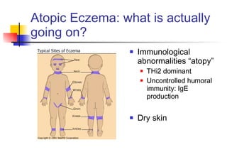 Atopic Eczema: what is actually going on? Immunological abnormalities “atopy” THi2 dominant Uncontrolled humoral immunity: IgE production Dry skin 