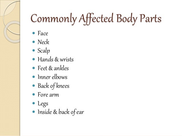 Eczema articles image