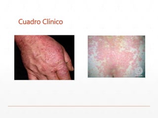 Cuadro Clínico 
 