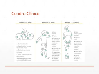 Cuadro Clínico 
 