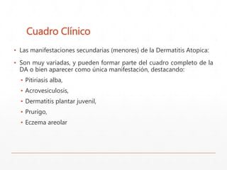 Cuadro Clínico 
▪ Las manifestaciones secundarias (menores) de la Dermatitis Atopica: 
▪ Son muy variadas, y pueden formar parte del cuadro completo de la 
DA o bien aparecer como única manifestación, destacando: 
▪ Pitiriasis alba, 
▪ Acrovesiculosis, 
▪ Dermatitis plantar juvenil, 
▪ Prurigo, 
▪ Eczema areolar 
 