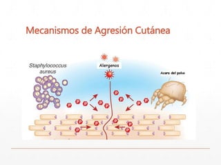 Mecanismos de Agresión Cutánea 
 