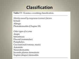 Classification
 
