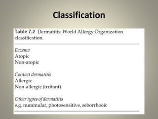 Classification
 